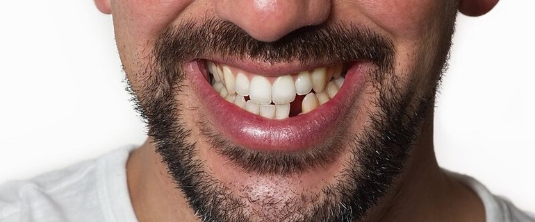 Почему у людей происходит выпадение зубов: основные причины и способы предотвращения