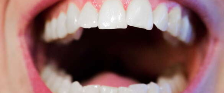 сколько дней заживает десна после удаления зуба для протезирования